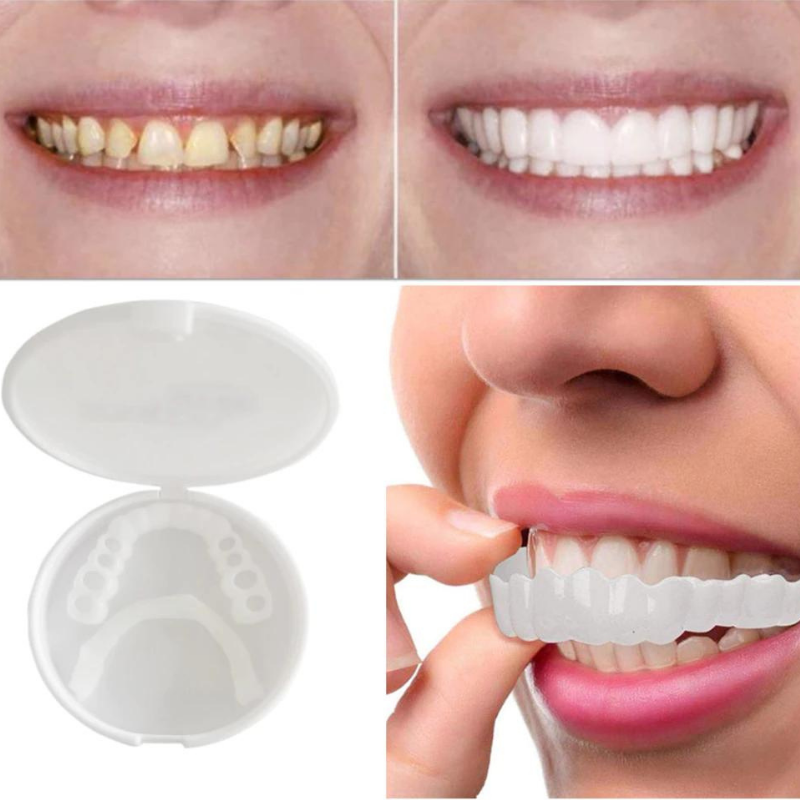 Snap-On Dentures™ De perfecte lach